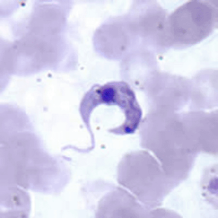Image: Trypanosoma cruzi, the causative agent of Chagas disease, in a thin blood film (photo courtesy Centers for Disease Control and Prevention [CDC]).